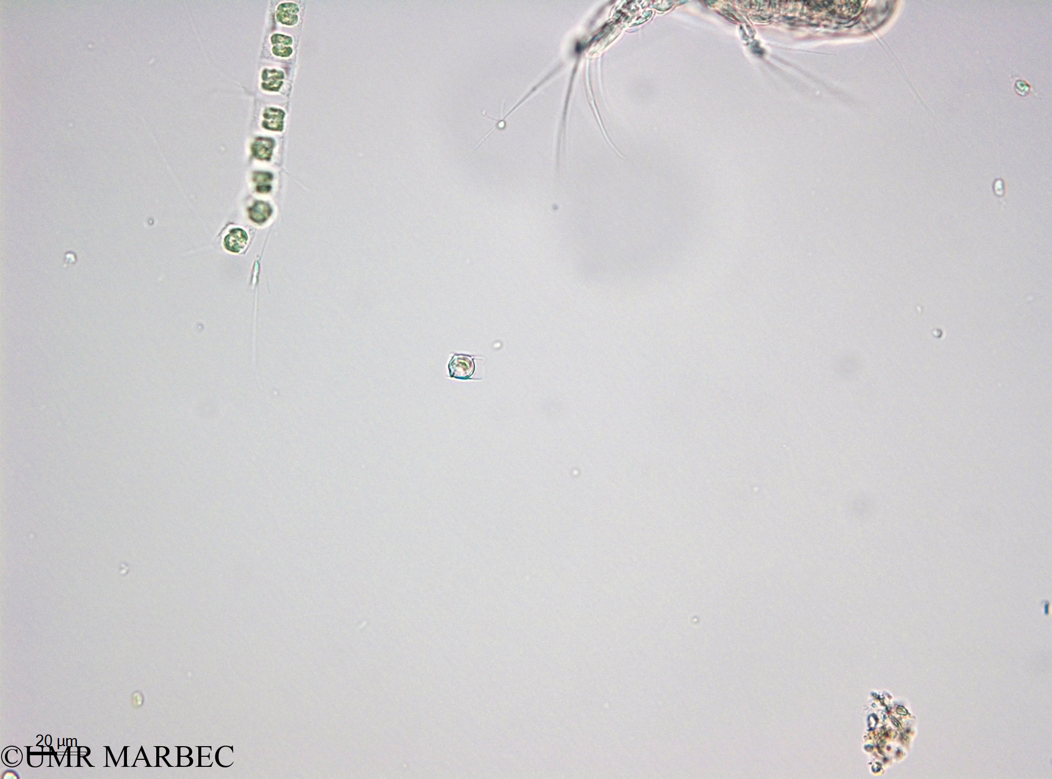 phyto/Thau_Lagoon/THAU_station1/OSU_plancton 2013/Chaetoceros spp (Hypnospores -40x -140211 -4)(copy).jpg